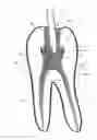 Fig. 04 - Methods and Devices for Treating Root Canals of Teeth