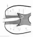 Fig. 05 - Methods and Devices for Treating Root Canals of Teeth