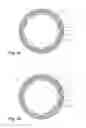 Fig. 05 - Dental implant socket arrangement