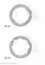 Fig. 06 - Dental implant socket arrangement
