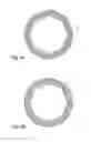 Fig. 07 - Dental implant socket arrangement