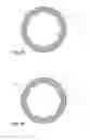 Fig. 08 - Dental implant socket arrangement