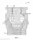 Fig. 02 - Fixed hybrid dental attachment assembly and methods of use