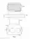 Fig. 04 - Fixed hybrid dental attachment assembly and methods of use