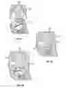 Fig. 07 - Fixed hybrid dental attachment assembly and methods of use