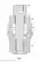 Fig. 08 - Fixed hybrid dental attachment assembly and methods of use