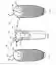 Fig. 03 - DENTAL IMPLANT INSERT ADAPTOR