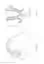 Fig. 03 - METHOD FOR MAXILLARY SINUS FLOOR ELEVATION
