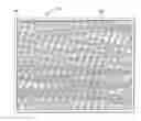 Fig. 01 - Mesh Fiber Members and Methods for Forming and Using Same for Treating Damaged Biological Tissue