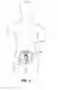 Fig. 02 - Implantable digestive tract organ