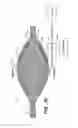 Fig. 19 - Implantable digestive tract organ