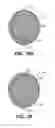 Fig. 20 - Implantable digestive tract organ
