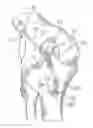 Fig. 01 - SUSPENSION DEVICE TO ANCHOR TISSUE GRAFT