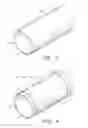 Fig. 03 - Regenerative Respiratory Tract Prostheses