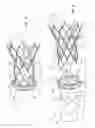 Fig. 02 - Collapsible valve having paravalvular leak protection