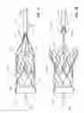 Fig. 13 - Collapsible valve having paravalvular leak protection