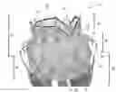 Fig. 01 - Replacement heart valve and method