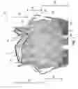 Fig. 02 - Replacement heart valve and method