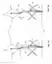 Fig. 08 - Replacement heart valve and method
