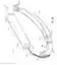Fig. 11 - Adjustable implant system