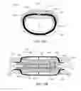 Fig. 17 - Adjustable implant system