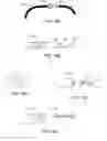 Fig. 21 - Adjustable implant system