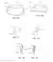 Fig. 22 - Adjustable implant system