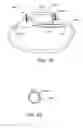 Fig. 23 - Adjustable implant system