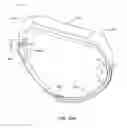 Fig. 24 - Adjustable implant system
