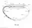 Fig. 25 - Adjustable implant system