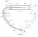 Fig. 26 - Adjustable implant system