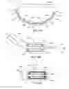 Fig. 28 - Adjustable implant system