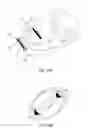 Fig. 38 - Adjustable implant system
