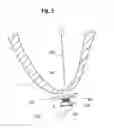 Fig. 06 - Epicardial anchor devices and methods