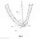 Fig. 07 - Epicardial anchor devices and methods