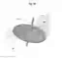Fig. 11 - Epicardial anchor devices and methods