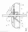 Fig. 16 - Epicardial anchor devices and methods