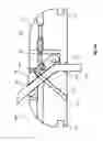 Fig. 17 - Epicardial anchor devices and methods