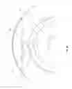 Fig. 31 - Epicardial anchor devices and methods