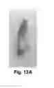 Fig. 12 - Joint bioscaffolds