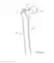Fig. 03 - Femoral neck support structure, system, and method of use