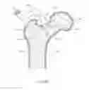 Fig. 06 - Femoral neck support structure, system, and method of use