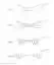Fig. 10 - Femoral neck support structure, system, and method of use
