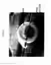 Fig. 06 - Intervertebral disc implant