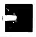 Fig. 07 - Intervertebral disc implant