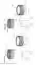Fig. 21 - Intervertebral disc implant