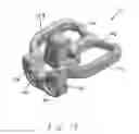Fig. 10 - Angulating bone plate