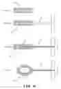 Fig. 16 - Expandable inter-vertebral cage and method of installing same