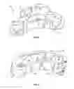 Fig. 04 - Expanding interbody implant and articulating inserter and method
