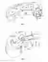 Fig. 05 - Expanding interbody implant and articulating inserter and method
